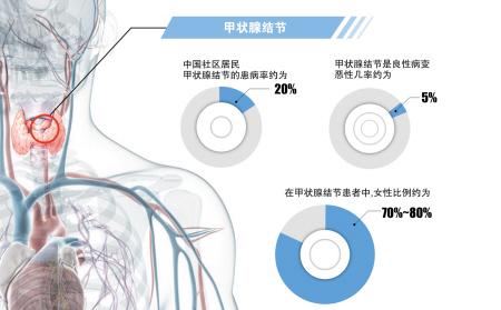 甲状腺结节六级有生命危险吗,甲状腺结节不治疗会不会发胖