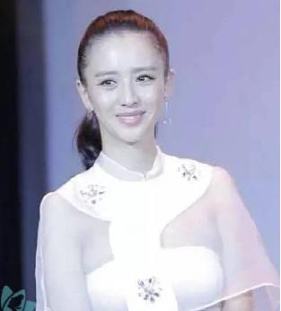 哪些女星整过发际线,发际线最惊人的女星