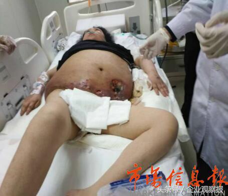 陕西延安“我佳纤体”美容坊涉嫌操作不当致一顾客死亡