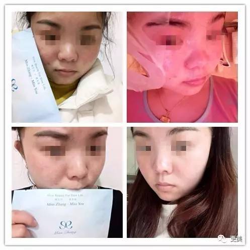 卖劣质面膜的明星,明星卖假化妆品后续