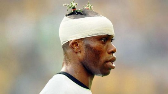 足球奇葩发型,法国足球怪异发型