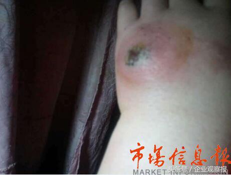 陕西延安“我佳纤体”美容坊涉嫌操作不当致一顾客死亡