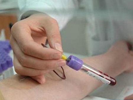 产检抽9管血对身体有伤害吗,产检一次抽8大管血