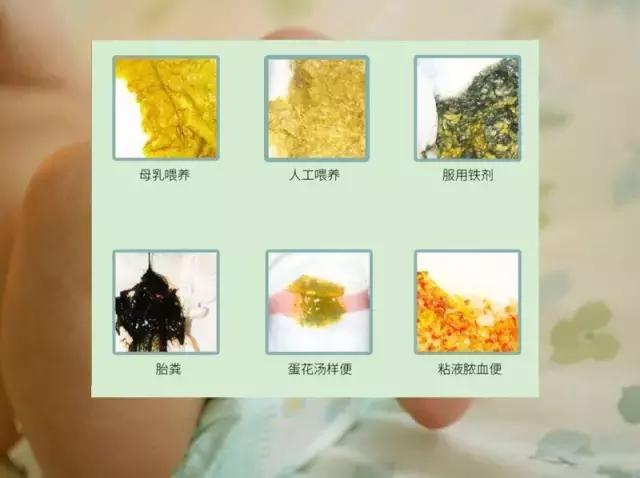 宝宝拉肚子不可不吃盐,宝宝拉肚子要少吃什么辅食