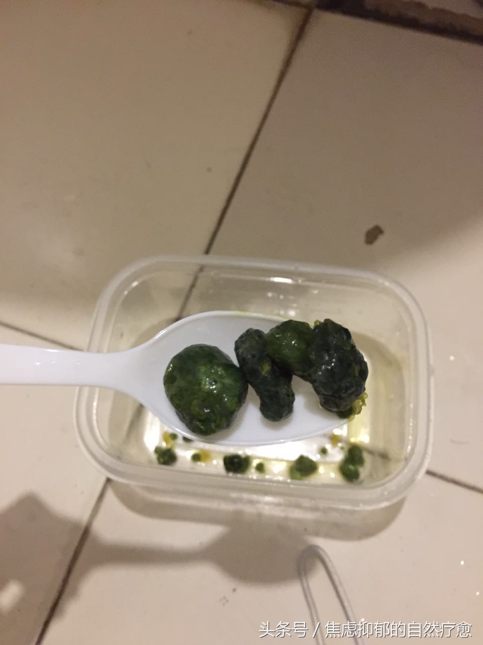 连载我如何用自然疗法战胜了自己11年的焦虑抑郁-肝胆净化原理