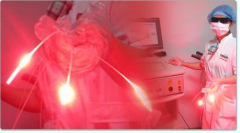 成都光动力治疗肿瘤专家有哪些,光动力治疗肿瘤的研究背景