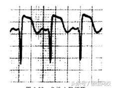 郭雅卿心电图讲解全集,郭雅卿心血管视频课