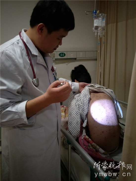 临沂水痘,沂水水痘