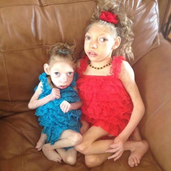 这位妈妈有两个患小头症的女儿,她家的画风是这样的