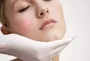 华山医院整形外科点痣,八大处整形外科哪个医生点痣好