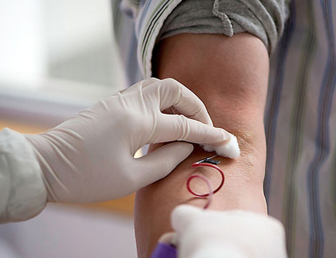 三院科普丨Zzz~打呼噜的“照妖镜”有哪些？