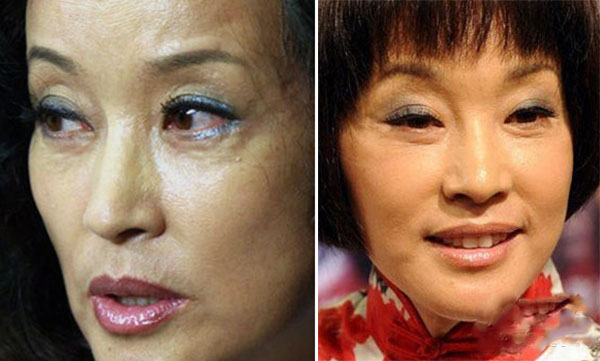 刘晓庆整容前后对比照吓人驻颜有术是骗人的!
