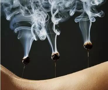 针灸是扎针跟艾灸吗,针灸如果针灸不对穴位会不会死