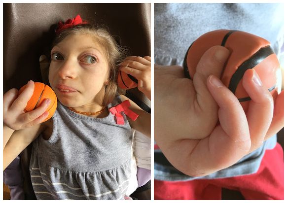 这位妈妈有两个患小头症的女儿,她家的画风是这样的