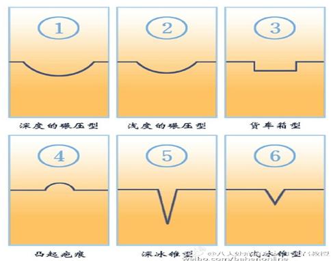 微针治痘坑涂碘伏,微针对深痘坑有效吗