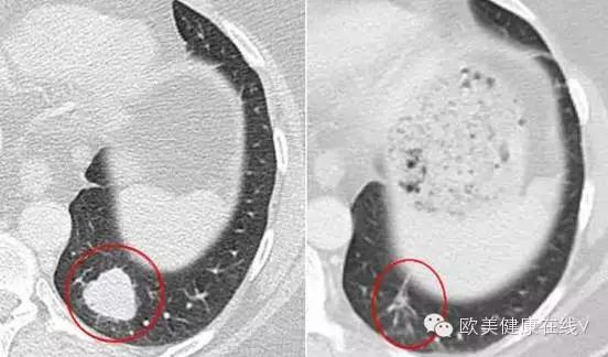 怎样才能到世界顶级医院看病,如何不花钱找专业人士