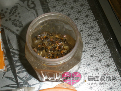 蜂毒对癌症有用吗,蜂毒治疗癌症