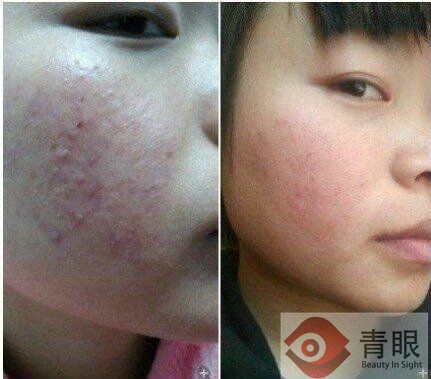 化妆品导购说我是“厚”脸皮，我竟无言以对