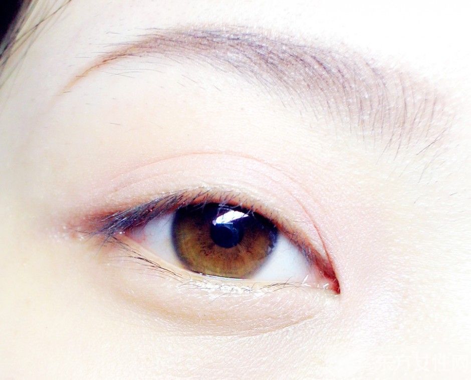 经常做眼部护理眼部会松弛吗,眼部皮肤松弛什么症状