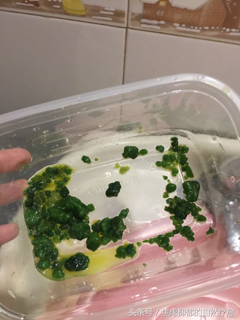 连载我如何用自然疗法战胜了自己11年的焦虑抑郁-肝胆净化原理