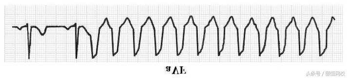 郭雅卿心电图讲解全集,郭雅卿心血管视频课