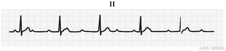 郭雅卿心电图讲解全集,郭雅卿心血管视频课