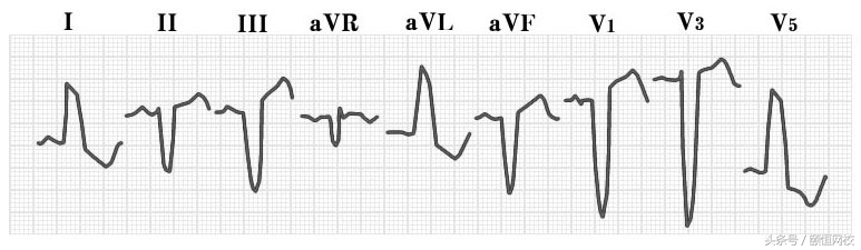郭雅卿心电图讲解全集,郭雅卿心血管视频课