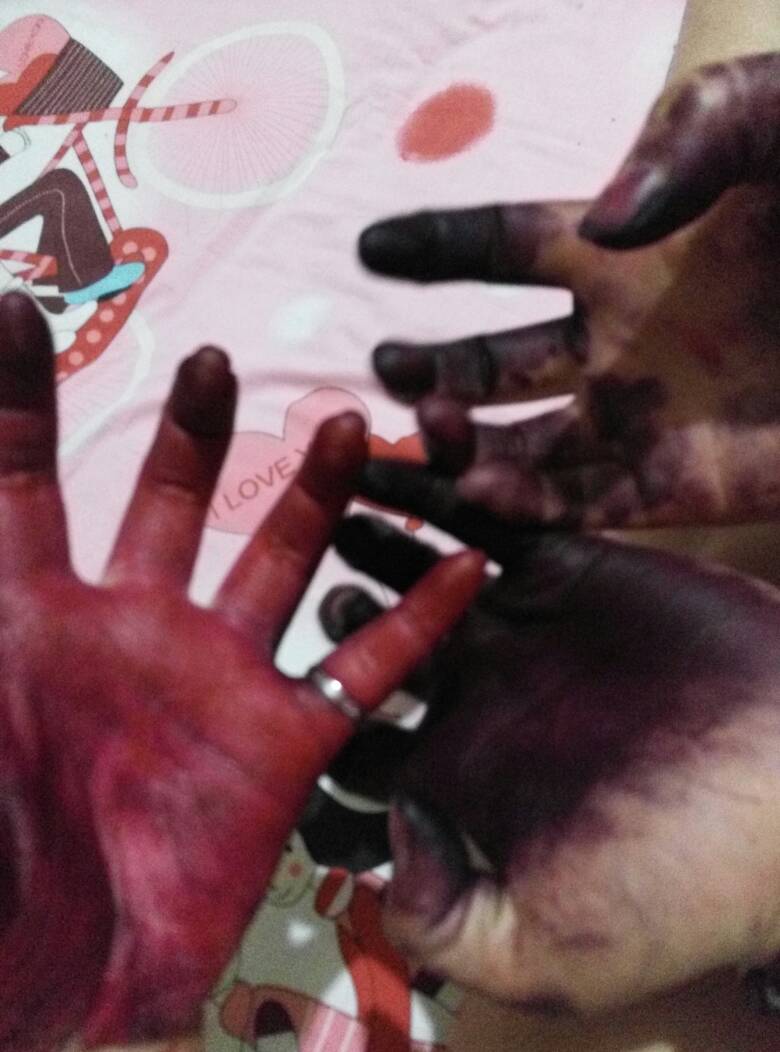 衣服上染上了染发剂怎么去除,染发剂沾到皮肤上怎么去除