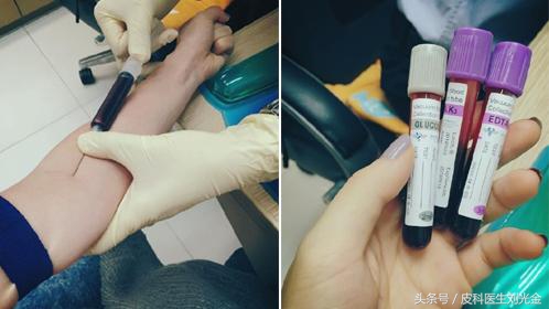 抽个血就能看出肝功能吗,抽个血可以查出什么病