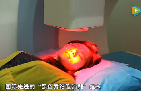 胎记拍婚纱照,肩膀有胎记怎么拍婚纱照