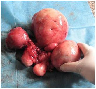 60岁女人有妇科炎症的表现,妇科炎症科普知识