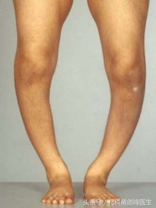 宝宝如何补维生素d,宝宝如何补维生素k