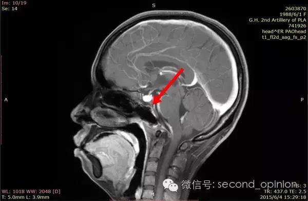 中国的质子中心有几家,全国有几所质子医院哪所最好