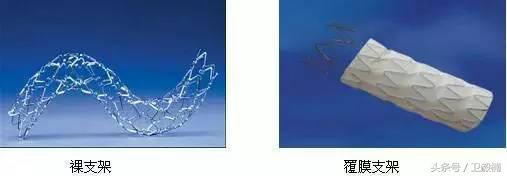 微创介入科一卫毅楠,什么是心血管介入治疗