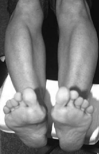 脚掌外展内收懒人瘦小腿三个动作,脚怎样着地跑得更快