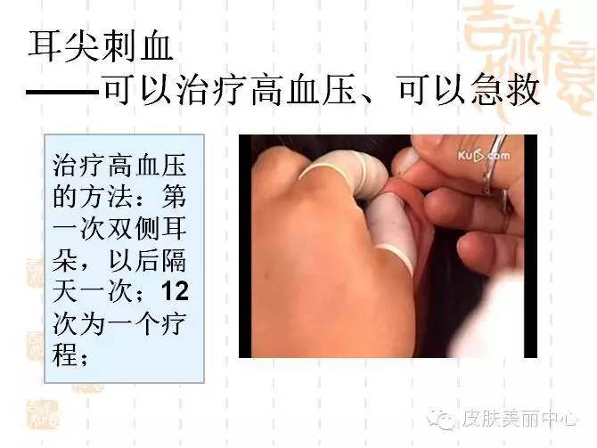 预防中风血栓的方法,怎么预防心脑血栓和脑梗