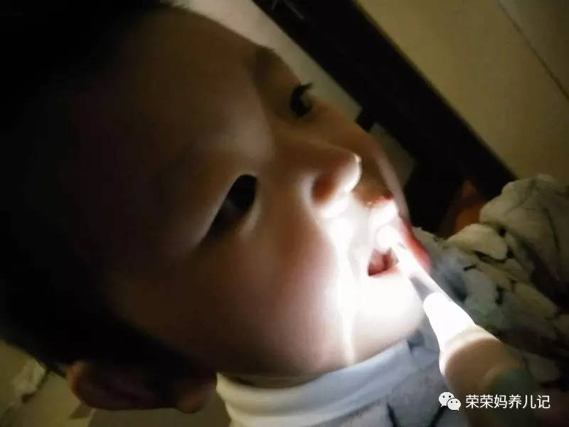 盘点李*荣大**的牙刷军团!其实吧,牙刷并不是重点,怎么刷才是!