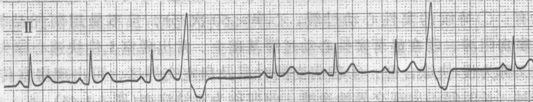 郭雅卿心电图讲解全集,郭雅卿心血管视频课