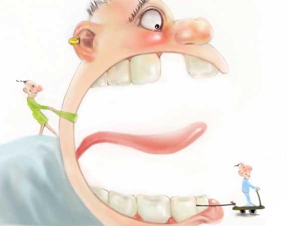 牙疼了就要拔神经吗,牙疼起来能要命