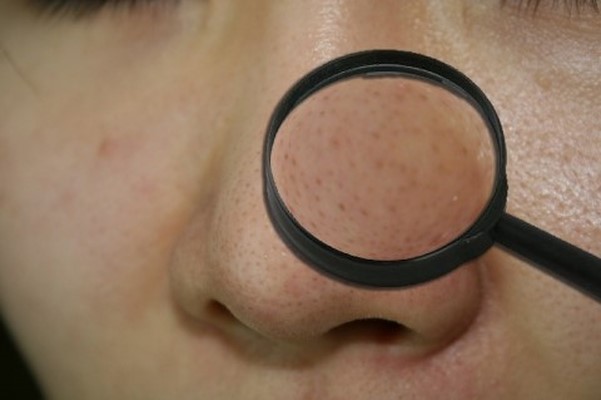 皮肤管理之毛孔粗治疗法,皮肤毛孔的改善方法