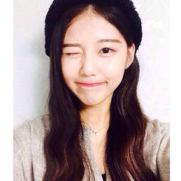 为什么有人会得痴笑性癫痫,十岁女孩总是无故发笑