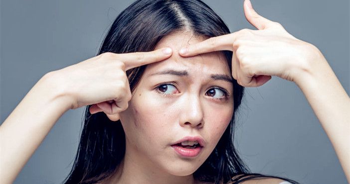 只是挤了一颗痘痘，却引发面部肿胀、发热，痘痘到底该不该挤？