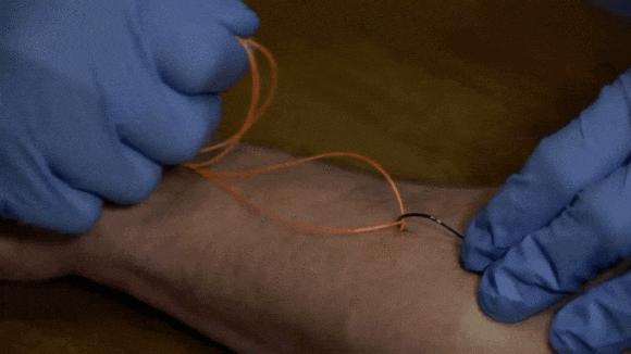 新手钓鱼怕被刺如何取钩,钓鱼钩扎到肉里怎么处理