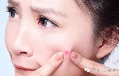 体质痰湿湿热,湿热体质和痰湿体质的区别