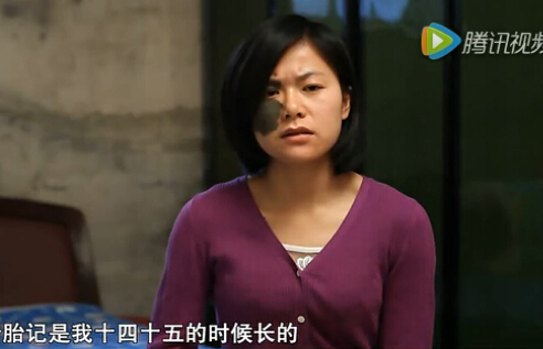 胎记拍婚纱照,肩膀有胎记怎么拍婚纱照