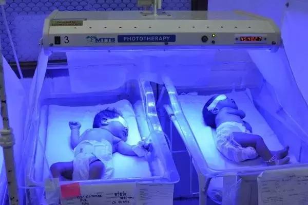 新生儿溶血性黄疸可怕吗,新生儿黄疸可怕不