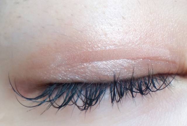 不开刀单眼皮怎么变双眼皮,内双不动刀怎么能变双眼皮