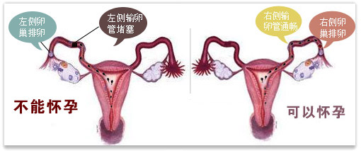 女性怀不了孕的各种原因分析,女人怀不了孕查哪一项
