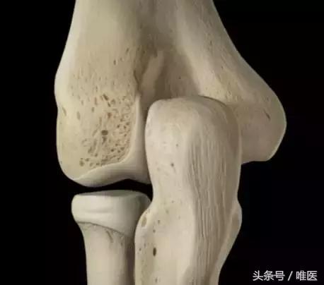 桡骨大头半脱位,远桡骨在哪个位置