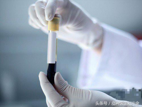 抽个血就能看出肝功能吗,抽个血可以查出什么病